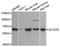 Solute Carrier Family 2 Member 2 antibody, A02297-1, Boster Biological Technology, Western Blot image 