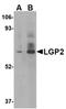 DExH-Box Helicase 58 antibody, orb74892, Biorbyt, Western Blot image 