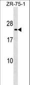 Transmembrane P24 Trafficking Protein 3 antibody, LS-C157210, Lifespan Biosciences, Western Blot image 