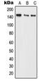 BMS1 Ribosome Biogenesis Factor antibody, GTX55918, GeneTex, Western Blot image 