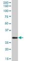 Complement C1q B Chain antibody, H00000712-B01P, Novus Biologicals, Western Blot image 