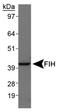 Hypoxia Inducible Factor 1 Subunit Alpha Inhibitor antibody, NBP1-30333, Novus Biologicals, Western Blot image 