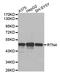 Reticulon 4 antibody, STJ25421, St John