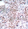 Estrogen Receptor 1 antibody, AP0145, ABclonal Technology, Immunohistochemistry paraffin image 