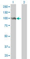 Forkhead Box M1 antibody, LS-C197232, Lifespan Biosciences, Western Blot image 