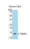 S100 Calcium Binding Protein B antibody, LS-C302492, Lifespan Biosciences, Western Blot image 