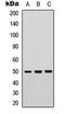 Protein Tyrosine Phosphatase Non-Receptor Type 1 antibody, orb304530, Biorbyt, Western Blot image 