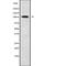 Solute Carrier Family 8 Member A1 antibody, abx218646, Abbexa, Western Blot image 