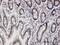 Interleukin Enhancer Binding Factor 3 antibody, H00003609-B01P, Novus Biologicals, Immunohistochemistry paraffin image 