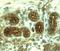 Neutrophil collagenase antibody, MAB9081, R&D Systems, Immunohistochemistry paraffin image 