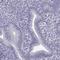 Synaptonemal Complex Central Element Protein 1 antibody, HPA040208, Atlas Antibodies, Immunohistochemistry frozen image 