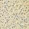 Sphingosine kinase 1 antibody, GTX33516, GeneTex, Immunohistochemistry paraffin image 