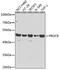 Protein C Receptor antibody, GTX65935, GeneTex, Western Blot image 