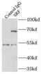 Serum Response Factor antibody, FNab08222, FineTest, Immunoprecipitation image 
