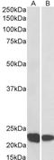 Rac Family Small GTPase 2 antibody, STJ70120, St John