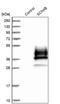 Sodium Voltage-Gated Channel Beta Subunit 4 antibody, PA5-53579, Invitrogen Antibodies, Western Blot image 