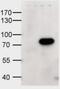 Interleukin 1 Receptor Associated Kinase 3 antibody, 45-778, ProSci, Western Blot image 