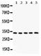 Hydroxysteroid 11-Beta Dehydrogenase 1 antibody, PA1372-1, Boster Biological Technology, Western Blot image 