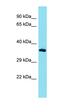 Sosondowah Ankyrin Repeat Domain Family Member D antibody, orb326908, Biorbyt, Western Blot image 