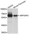 ADP Ribosylation Factor GTPase Activating Protein 3 antibody, A8204, ABclonal Technology, Western Blot image 