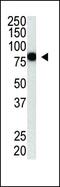 Protein Inhibitor Of Activated STAT 4 antibody, PA5-11347, Invitrogen Antibodies, Western Blot image 