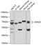 Zinc Finger Protein 20 antibody, GTX65596, GeneTex, Western Blot image 
