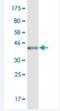 POU Class 6 Homeobox 2 antibody, H00011281-M05, Novus Biologicals, Western Blot image 