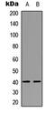 Distal-Less Homeobox 3 antibody, LS-C355997, Lifespan Biosciences, Western Blot image 