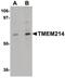 Transmembrane protein 214 antibody, PA5-20791, Invitrogen Antibodies, Western Blot image 