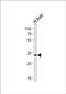 Leucine Rich Transmembrane And O-Methyltransferase Domain Containing antibody, PA5-49421, Invitrogen Antibodies, Western Blot image 