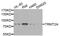 TRNA Methyltransferase 2 Homolog A antibody, abx006425, Abbexa, Western Blot image 