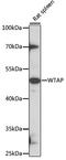 WT1 Associated Protein antibody, LS-C749681, Lifespan Biosciences, Western Blot image 