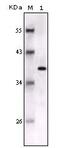 S100 Calcium Binding Protein B antibody, MA5-15359, Invitrogen Antibodies, Western Blot image 