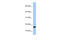 Plasminogen Receptor With A C-Terminal Lysine antibody, 26-391, ProSci, Western Blot image 