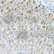 Metaxin 2 antibody, A7958, ABclonal Technology, Immunohistochemistry paraffin image 