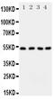 Serine palmitoyltransferase 1 antibody, PA1777, Boster Biological Technology, Western Blot image 