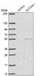 Solute Carrier Family 33 Member 1 antibody, NBP1-90811, Novus Biologicals, Western Blot image 