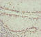 Platelet Derived Growth Factor Receptor Like antibody, LS-C676234, Lifespan Biosciences, Immunohistochemistry paraffin image 