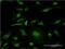 Mitogen-Activated Protein Kinase 10 antibody, H00005602-M01, Novus Biologicals, Immunocytochemistry image 