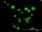 ATP Synthase Inhibitory Factor Subunit 1 antibody, H00093974-M01, Novus Biologicals, Immunocytochemistry image 