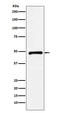 C-Terminal Binding Protein 2 antibody, M02567-2, Boster Biological Technology, Western Blot image 