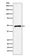 C-terminal-binding protein 2 antibody, M02567-2, Boster Biological Technology, Western Blot image 