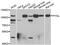 Glycogen Phosphorylase L antibody, PA5-76996, Invitrogen Antibodies, Western Blot image 