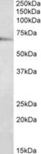 TRAF3 Interacting Protein 2 antibody, A02179, Boster Biological Technology, Western Blot image 