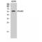 Interferon Alpha And Beta Receptor Subunit 2 antibody, LS-C387125, Lifespan Biosciences, Western Blot image 