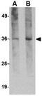 HCLS1 Associated Protein X-1 antibody, GTX84984, GeneTex, Western Blot image 