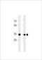60S acidic ribosomal protein P0-like antibody, A18823, Boster Biological Technology, Western Blot image 