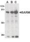 Sterile Alpha And TIR Motif Containing 1 antibody, PA5-20059, Invitrogen Antibodies, Western Blot image 