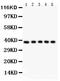 FAS antibody, LS-C357416, Lifespan Biosciences, Western Blot image 