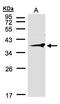 RNF2 antibody, PA5-28453, Invitrogen Antibodies, Western Blot image 